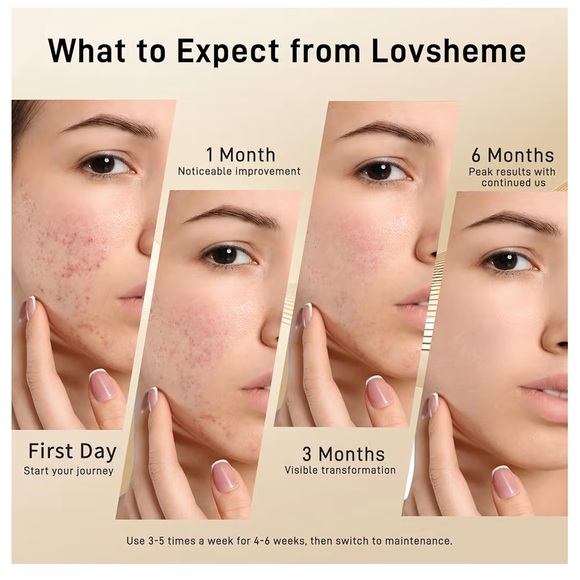 LED Light Therapy Mask - Picture 4 of 9